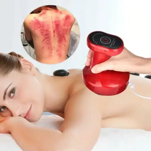 Ultracavitat™ Anti Cellulite Electric Suction Cup 2